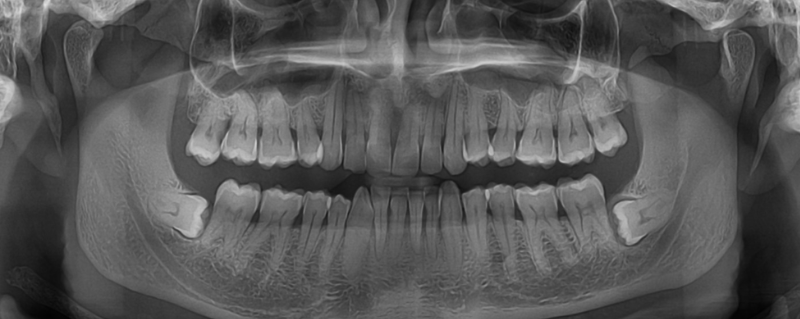 Diagnostic Techniques